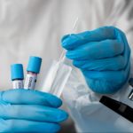 Teste de antígeno COVID-19: entenda melhor sobre o teste rápido e seguro